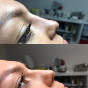 00003 gabinet medycyny estetycznej