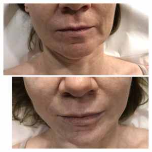 00008 gabinet medycyny estetycznej