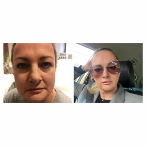 00011 gabinet medycyny estetycznej