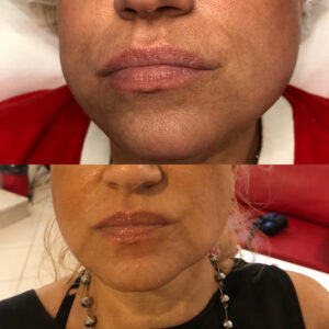 00014 gabinet medycyny estetycznej