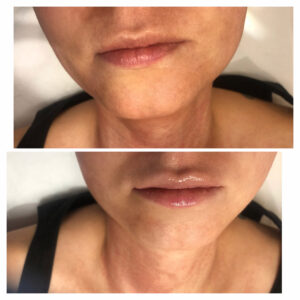 00023 gabinet medycyny estetycznej