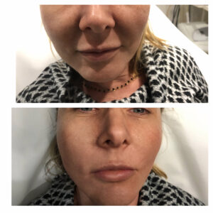 00024 gabinet medycyny estetycznej