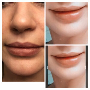 00042 gabinet medycyny estetycznej