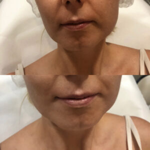 00044 gabinet medycyny estetycznej