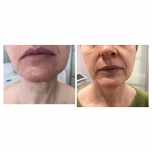 00046 gabinet medycyny estetycznej